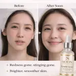 SOON SKIN NATURALS SERUM – Hydrating & Brightening Face Serum | Lightweight Daily Skincare